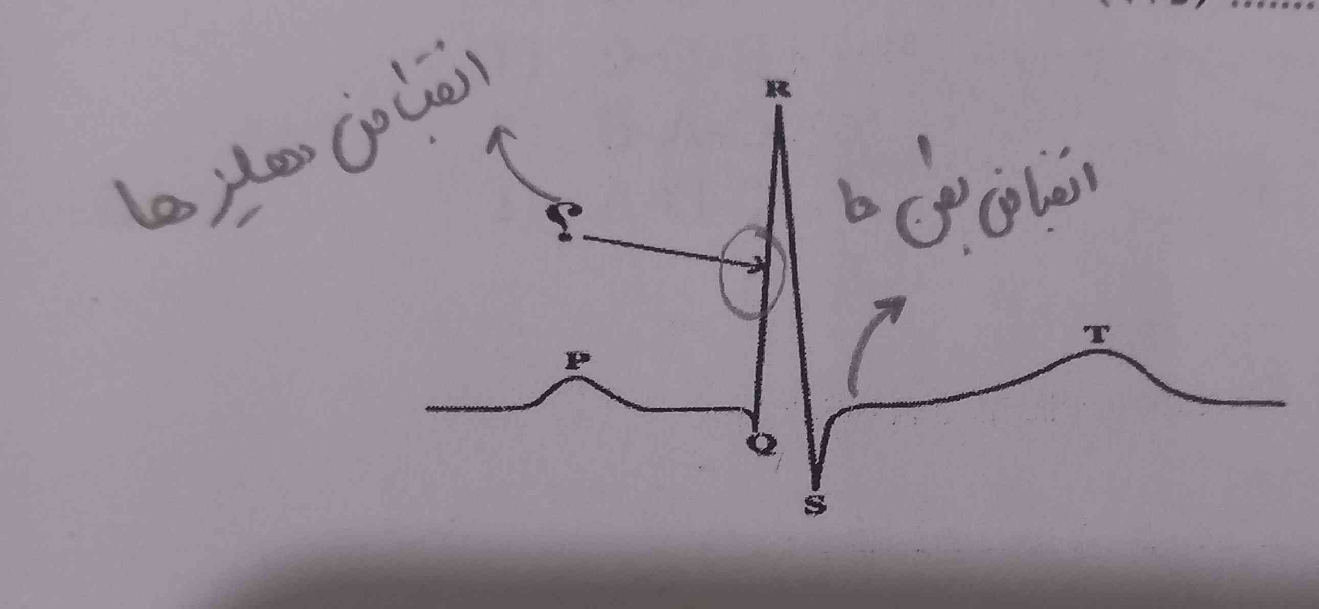 قسمت Q. R چجور انقباض دهلیزی اتفاق میوفته؟
مگه بین Q ,R,S انقباض بطن ها نیست؟