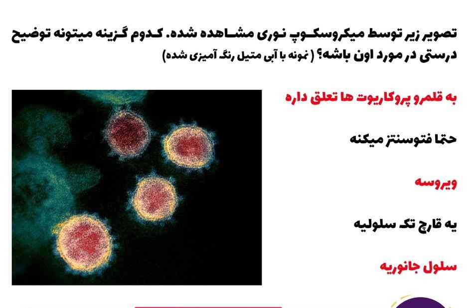 کدام گزینه توضیح درستی برای عکس است ؟!