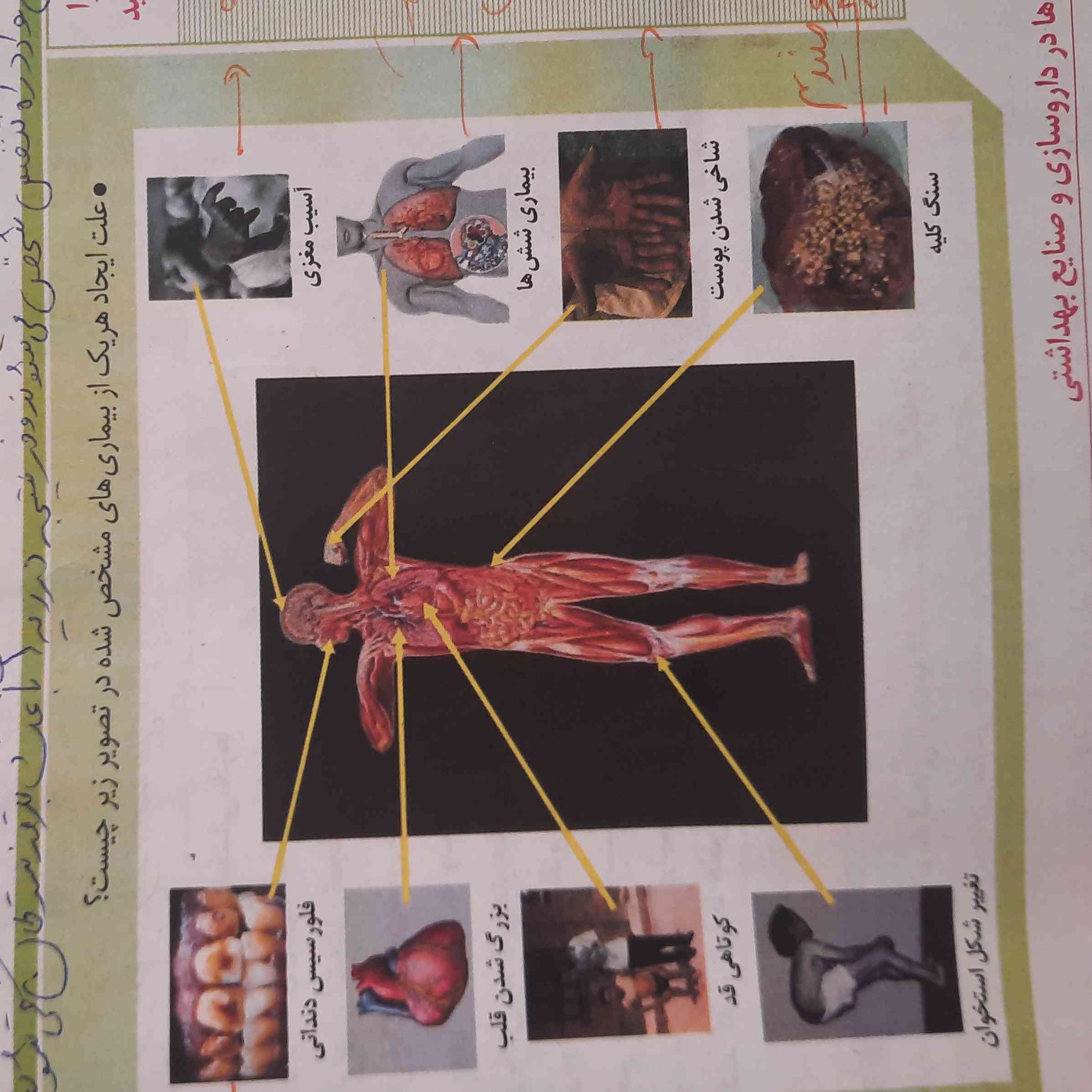 بچه ها توروخدا یکی این صفحه ۹۰ یادآوری رو جوابشو میگه؟؟
احساس میکنم گوگل اینا اشتباه میگه
تغییر شکل استخوان میشه کادمیم و فزونی فلوئور
یا سنگ کلیه باتوجه به متن کتاب فقط میشه فزونی کلسیم و کادمیم